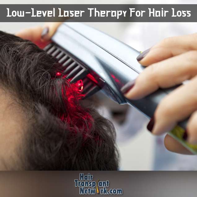 Illustration for article titled Low-Level Laser Therapy For Hair Loss